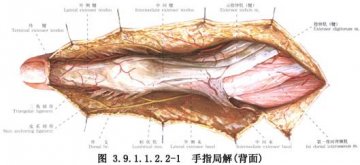 指总伸肌腱修复术 