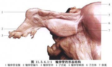 腹部输卵管结扎术 